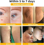 Bee Venom Skin Treatment Cream,Repair Maximum Strength for All Skin Types (2PCS)